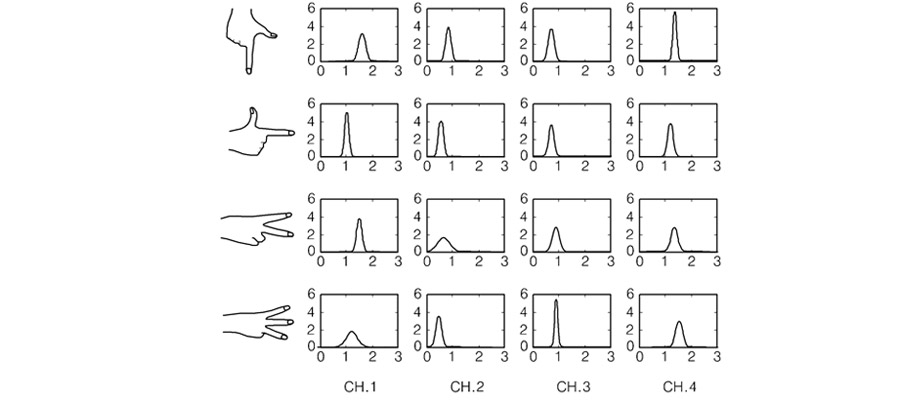 Électromyogramme