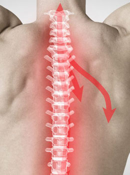 Arthrose cervicale : douleurs dans la colonne vertébrale